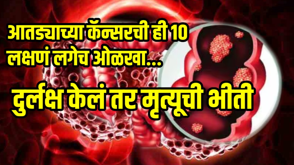 colorectal cancer is life threatening know what are the early sign and symptoms