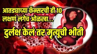 colorectal cancer is life threatening know what are the early sign and symptoms