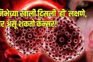 What are the first signs of cancer of the tongue know the tongue cancer sign and symptoms and cure