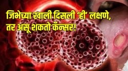 जिभेचा कॅन्सर झाला तर सुरुवातीलाच दिसतात ‘ही’ लक्षणं; दुर्लक्ष न करता डॉक्टरांनी सांगितलेली माहिती वाचा