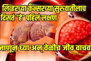 what is the first sign of liver cancer is it treatable what is the last stage of liver cancer know everything