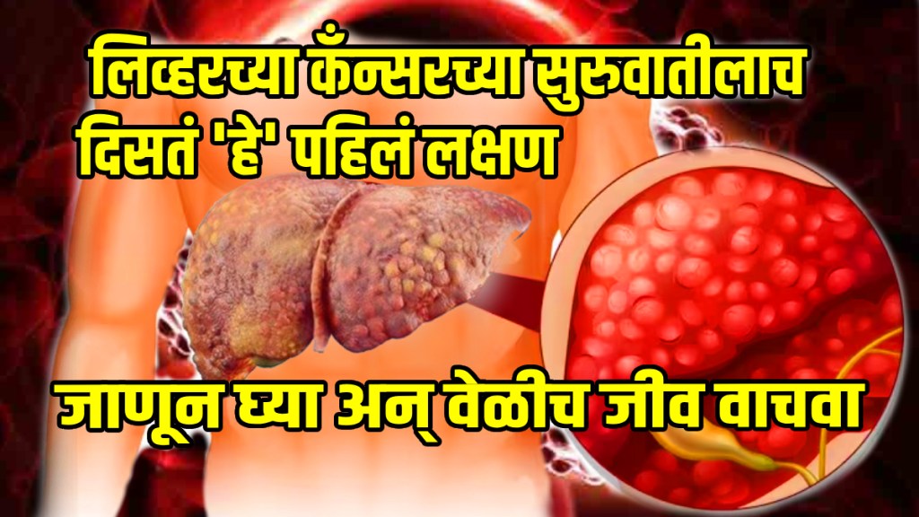 what is the first sign of liver cancer is it treatable what is the last stage of liver cancer know everything