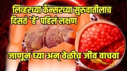 लिव्हरच्या कँन्सरचे पहिले लक्षण काय? साधी वाटणारी ‘ही’ लक्षणं अजिबात दुर्लक्ष करु नका; जाणून घ्या अन् वेळीच जीव वाचवा