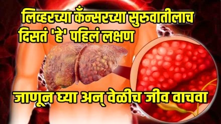 what is the first sign of liver cancer is it treatable what is the last stage of liver cancer know everything