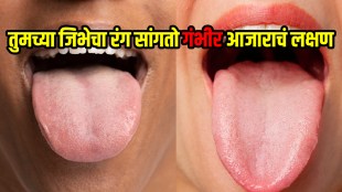 Tongue color can reveals your diseases warning signs in tongues