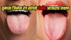 तुमच्याही जिभेचा रंग ‘या’ प्रकारे दिसत असेल तर आत्ताच सावध व्हा; पोषणतज्ञांनी सांगितली गंभीर आजाराची लक्षणं