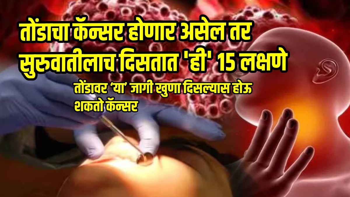 तोंडाचा कर्करोग प्रारंभिक लक्षणे हे चिन्ह कसे ओळखावे हे माहित आहे तज्ञ कर्करोगाच्या आरोग्याच्या बातम्या मराठी