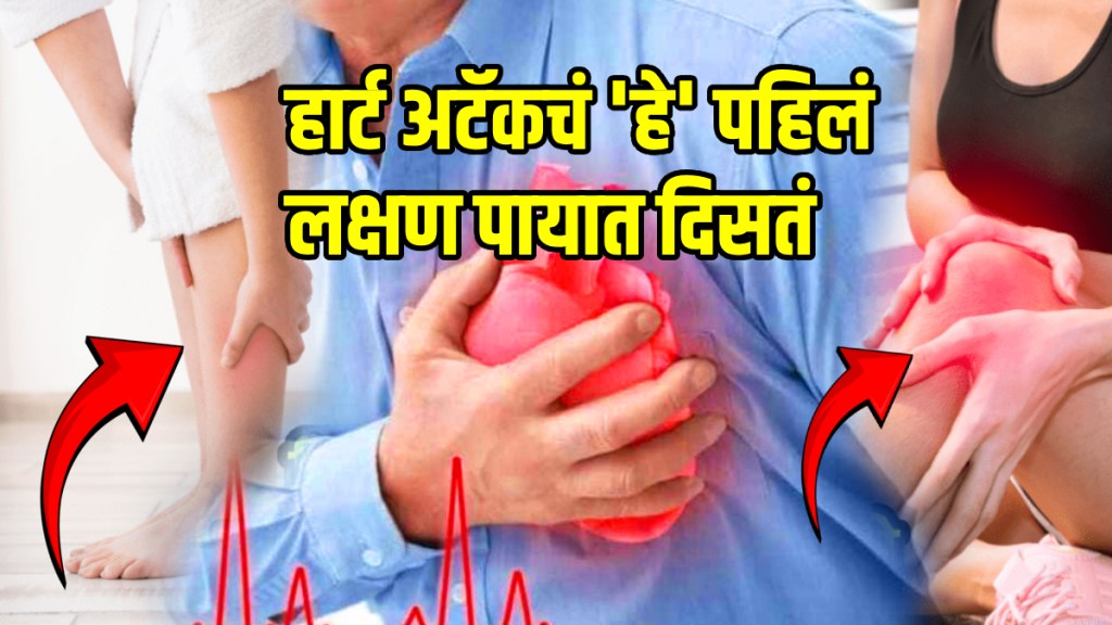 Heart disease heart attack signs spot on leg and feet chest pain