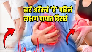 Heart disease heart attack signs spot on leg and feet chest pain