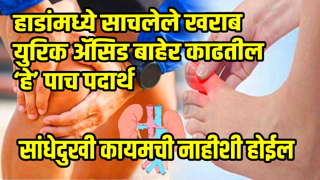 these 4 remedies reduce uric acid naturally what to eat when uric acid increases ways to reduce uric acid and joint pain relief
