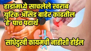 these 4 remedies reduce uric acid naturally what to eat when uric acid increases ways to reduce uric acid and joint pain relief