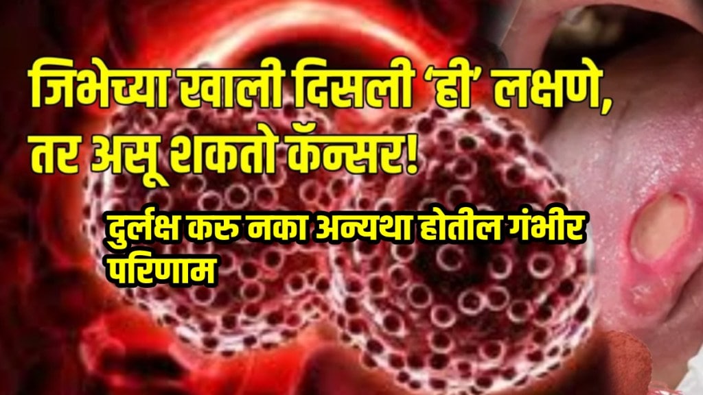 Tongue cancer sign and symptoms and cure what are the first signs of cancer of the tongue know more Health news in marathi