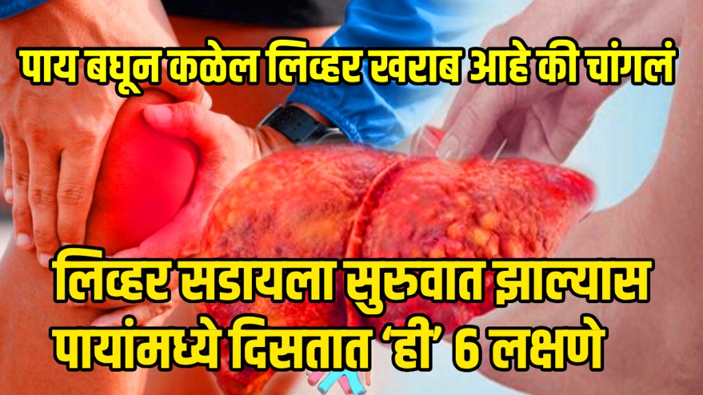 What are the signs and symptoms of fatty liver disease in the feet is foot swelling itching or pain in the soles a sign of fatty liver