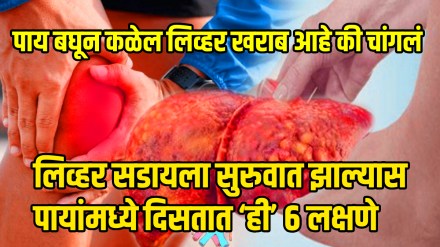 What are the signs and symptoms of fatty liver disease in the feet is foot swelling itching or pain in the soles a sign of fatty liver