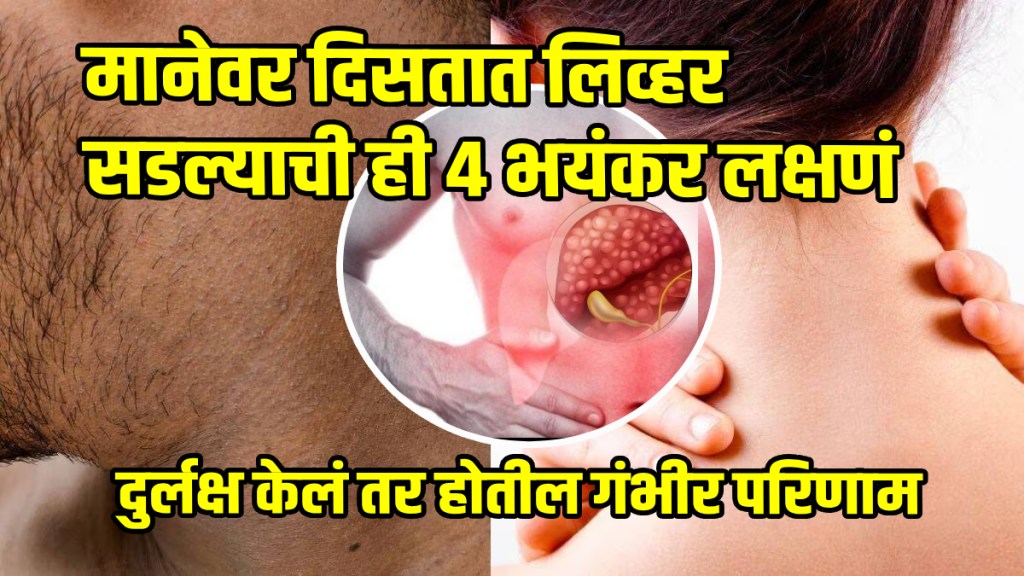 4 Symptoms And Signs Of Liver Damage That Appear On Neck