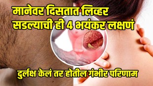4 Symptoms And Signs Of Liver Damage That Appear On Neck