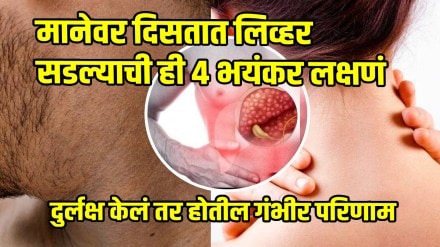 4 Symptoms And Signs Of Liver Damage That Appear On Neck