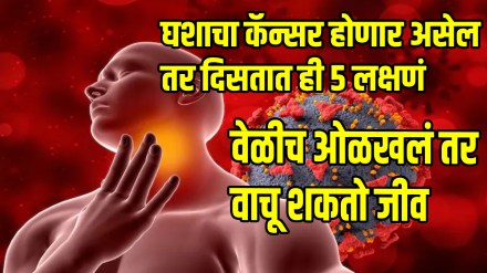 Throat cancer sign symptoms and treatment know how to recognize sore throat cancer