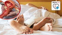 PCOD मुळे महिलांच्या लैगिंक आरोग्यावर होतात ‘हे’ गंभीर परिणाम; काय काळजी घ्यावी? डॉक्टरांनी सांगितले उपाय