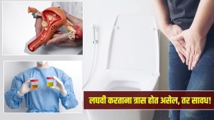 Bladder cancer warning signs