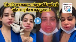 उर्फी जावेदने लिप फिलर काढल्यानंतर सुजले ओठ अन् चेहरा! लिप फिलर करताना कोणत्या चुका टाळाव्यात? तज्ज्ञांकडून जाणून घ्या