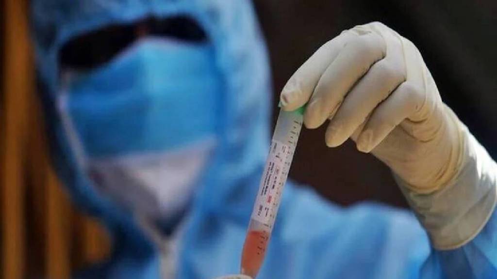 Sickle cell anemia and hepatitis B test kits now available in every village