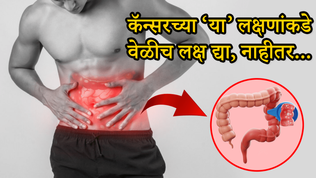 cancer symptoms in body colon cancer signs constipation piles can be cancer causes
