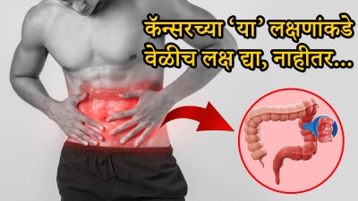 शरीरात दिसतात आतड्यांच्या कॅन्सरची ही लक्षणे! अजिबात दुर्लक्ष करू नका, नाहीतर…