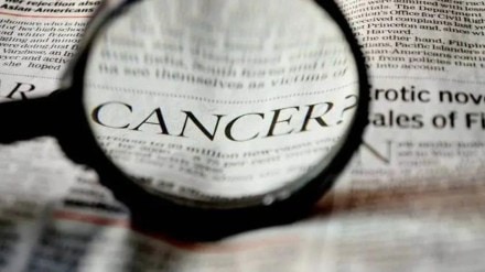 prostate cancer Symptoms