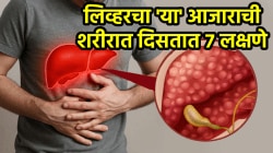 ‘सायलेंट किलर’ आहे फॅटी लिव्हरचा आजार! लिव्हरमध्ये चरबी वाढताच शरीरात दिसतात ‘ही’ ७ लक्षणे, दुर्लक्ष करणं पडू शकतं महागात