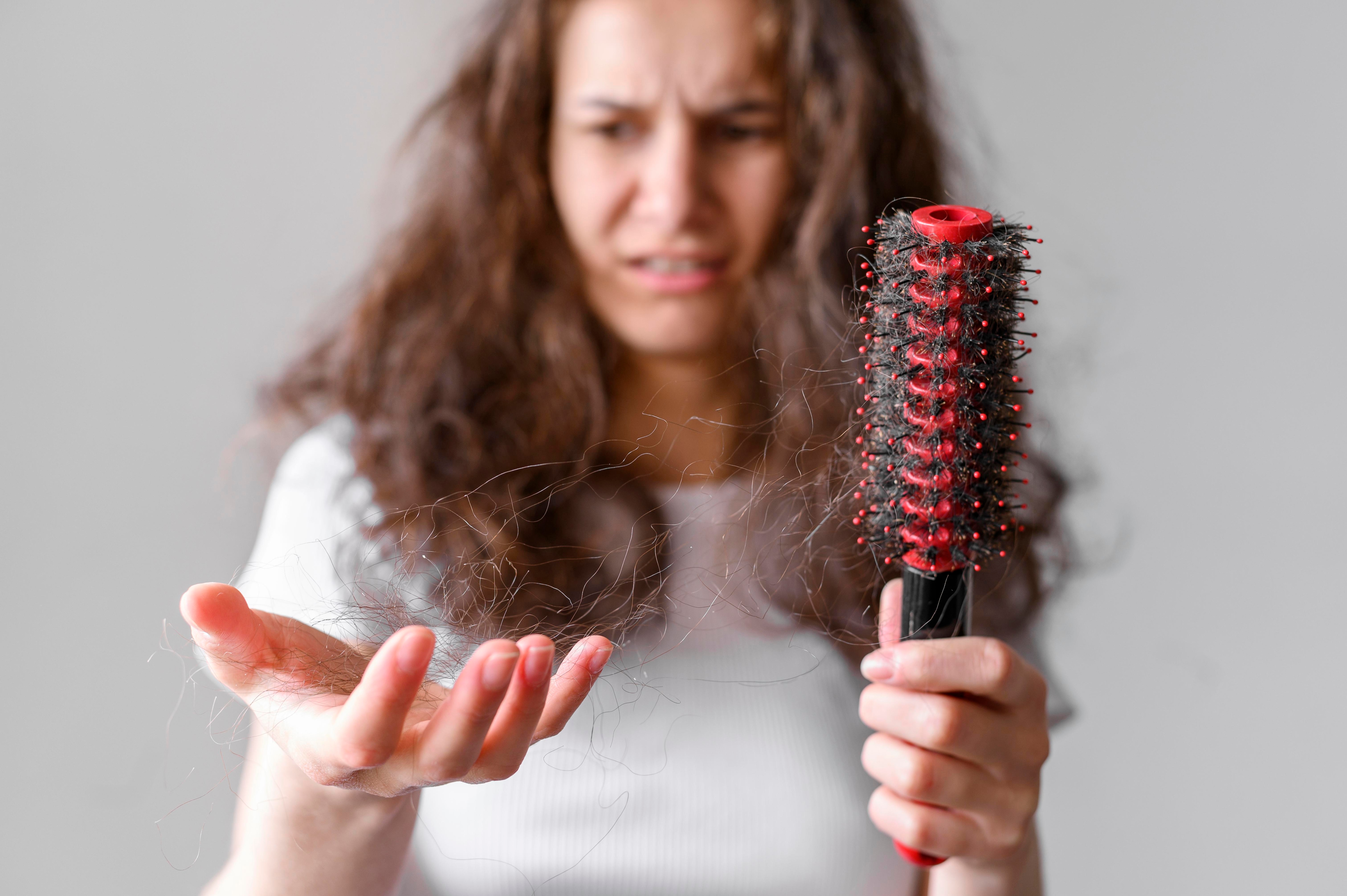 hairloss