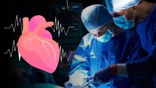 For the first time in Solapur, complex heart surgery is performed with the help of AI