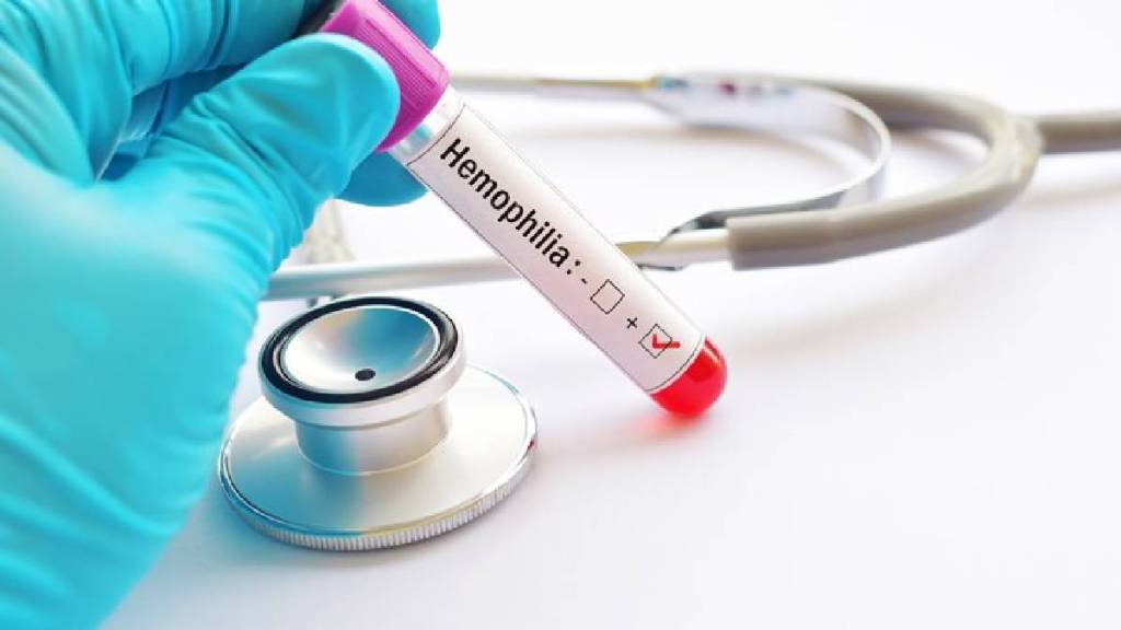 Hemlibra injection for the hereditary blood disease hemophilia has become available in Parbhani district