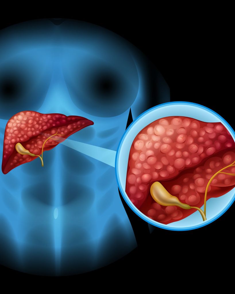 Fatty Liver Detox Drink