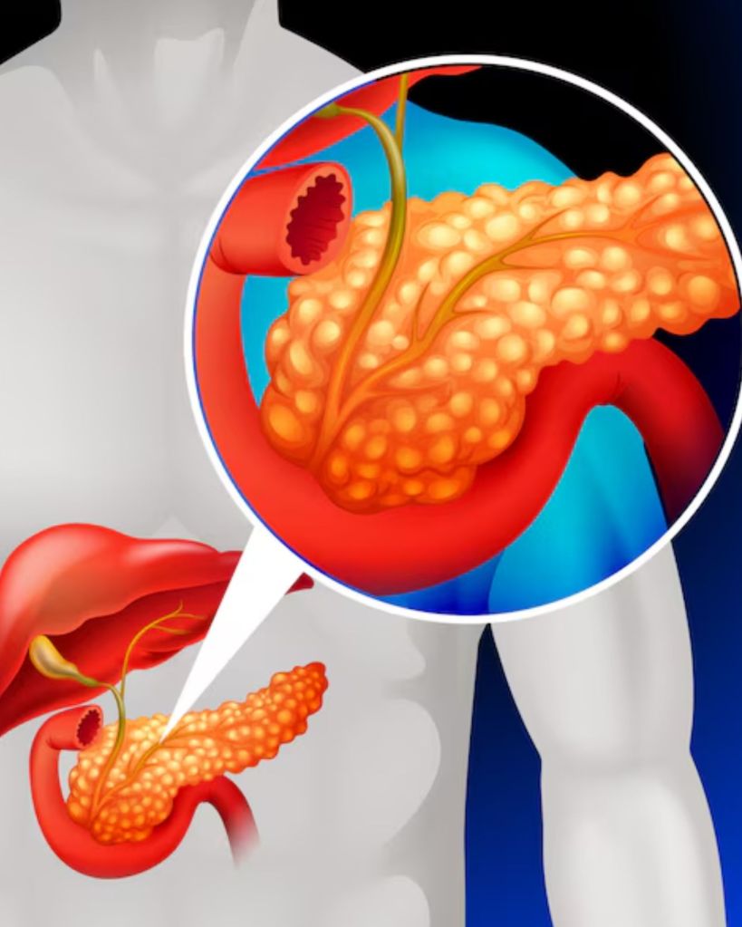gallbladder removal