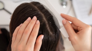 डोक्याला खाज येतेय? कोंडा की ड्राय स्कॅल्प यामधील फरक कसा ओळखाल?