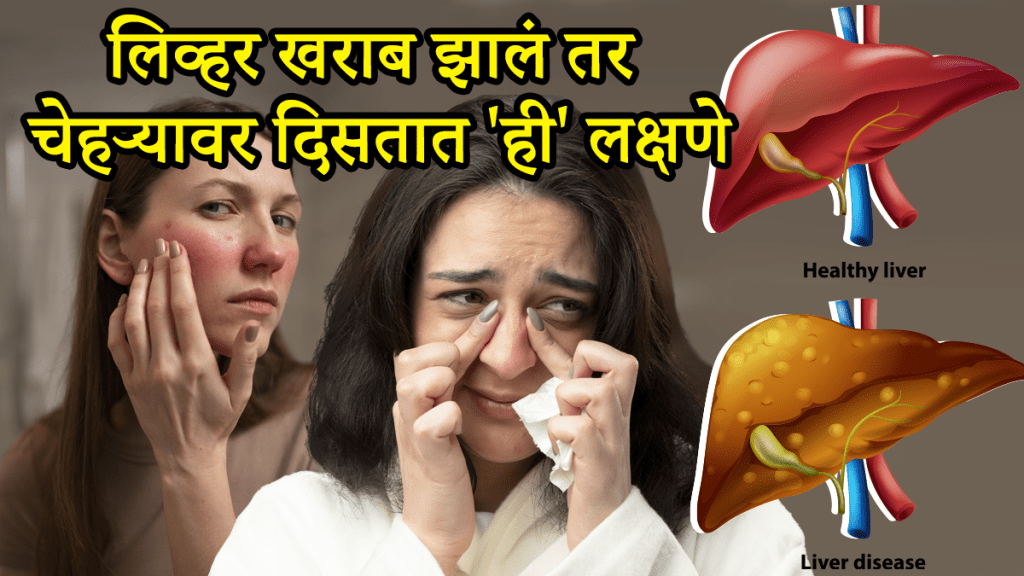 liver disease symptoms on face liver damage signs doctor advice how to keep liver healthy liver health tips