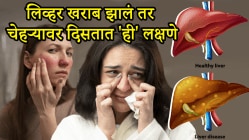 लिव्हर खराब असेल तर चेहऱ्यावर दिसतात ‘ही’ ५ लक्षणे, लगेच सावध व्हा! डॉक्टरांचा सल्ला एकदा वाचाच…