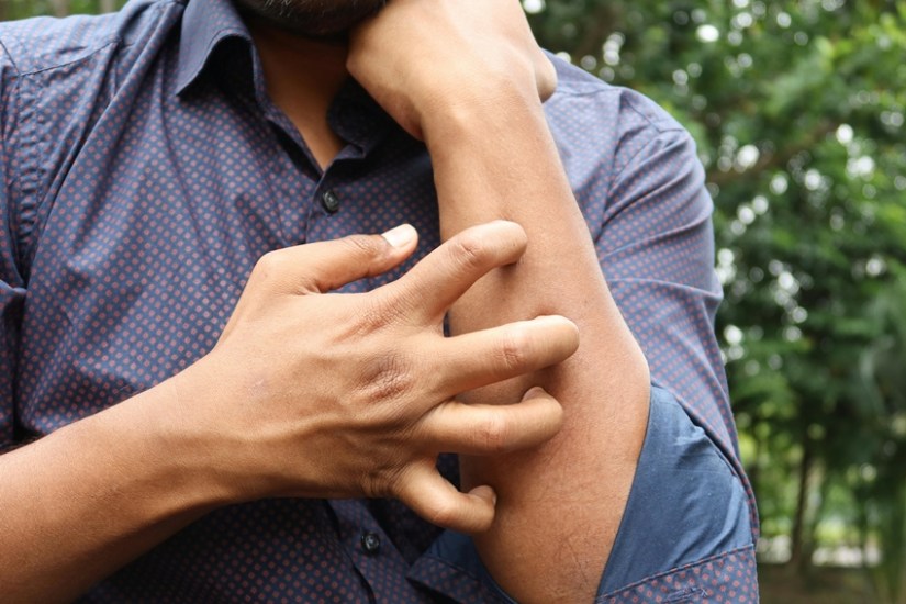 Monsoon Health Tips Why Sour Foods Can Upset Your Digestion