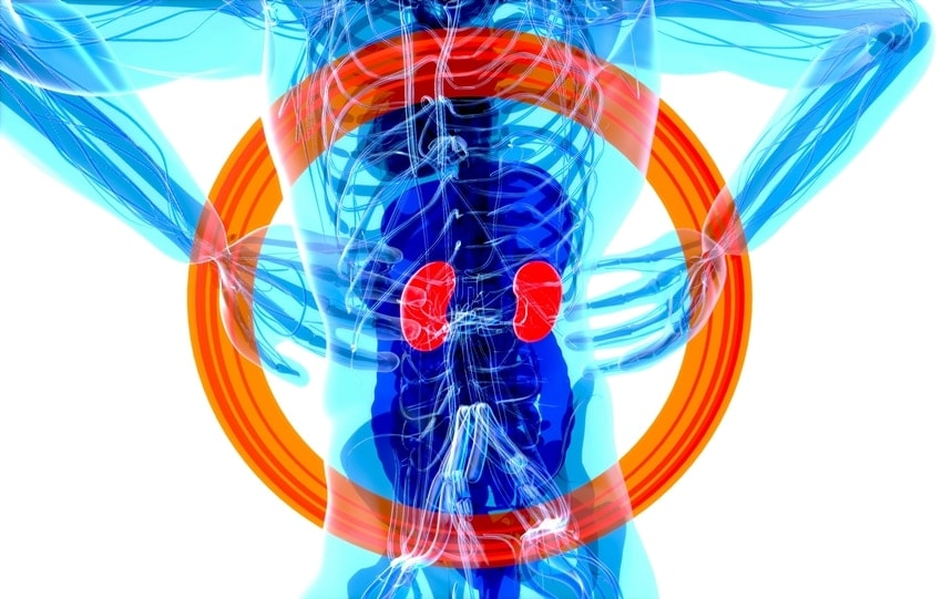 Simple and Natural How to Detox Your Kidneys with Everyday Foods