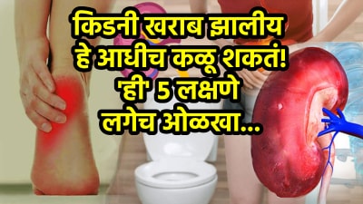 किडनी हळूहळू होते खराब! ‘या’ ५ लक्षणांकडे लोक करतात दुर्लक्ष, वाचा डॉक्टरांचा सल्ला