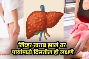 liver health signs spot on leg and feet live failure and damage symptoms