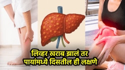 पाय बघून कळेल लिव्हर खराब आहे की चांगलं! ‘ही’ ६ लक्षणे असतील तर दुर्लक्ष करू नका, नाहीतर…