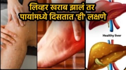 लिव्हर खराब झालं तर पायांमध्ये दिसतात ‘ही’ ६ लक्षणे! लगेच काळजी घ्या नाहीतर…