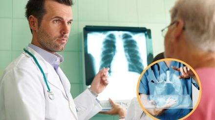 Lung Cancer Symptoms