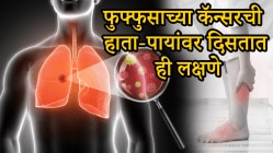 हाता-पायांवर दिसतात ‘या’ कॅन्सरची सुरूवातीची लक्षणे; दुर्लक्ष केलं तर जीवावर बेतेल, वेळीच जाणून घ्या…