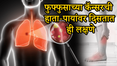 हाता पायांवर दिसतात या कॅन्सरची सुरूवातीची लक्षणे; दुर्लक्ष केलं तर जीवावर बेतेल…