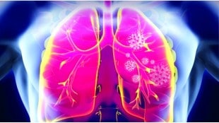 lung-cancer-women-smoking-kitchen-smoke
