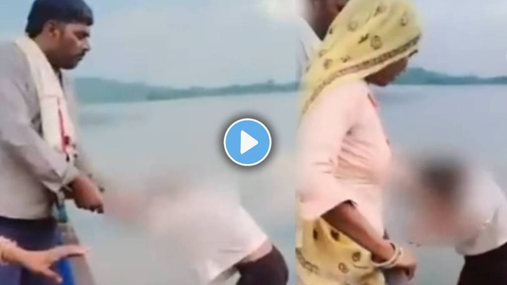 boys hair catches fire during birthday celebration