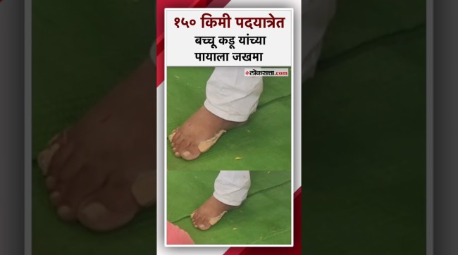 बच्चू कडू यांच्या पायाला जखम; तरीही विनाचप्पल पदयात्रा कायम